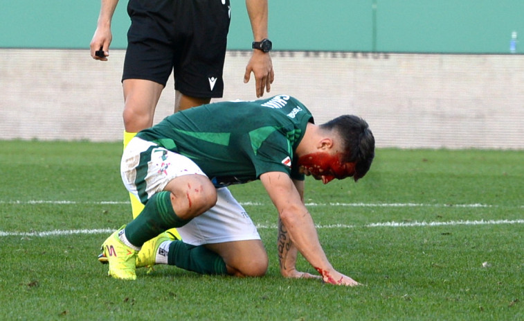 Racing de Ferrol contra Oviedo el partido en imágenes